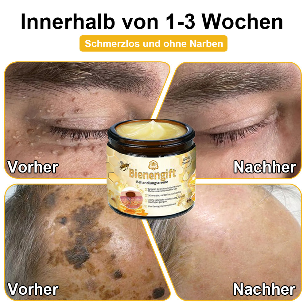 6 Flaschen-Beste Ergebnisse