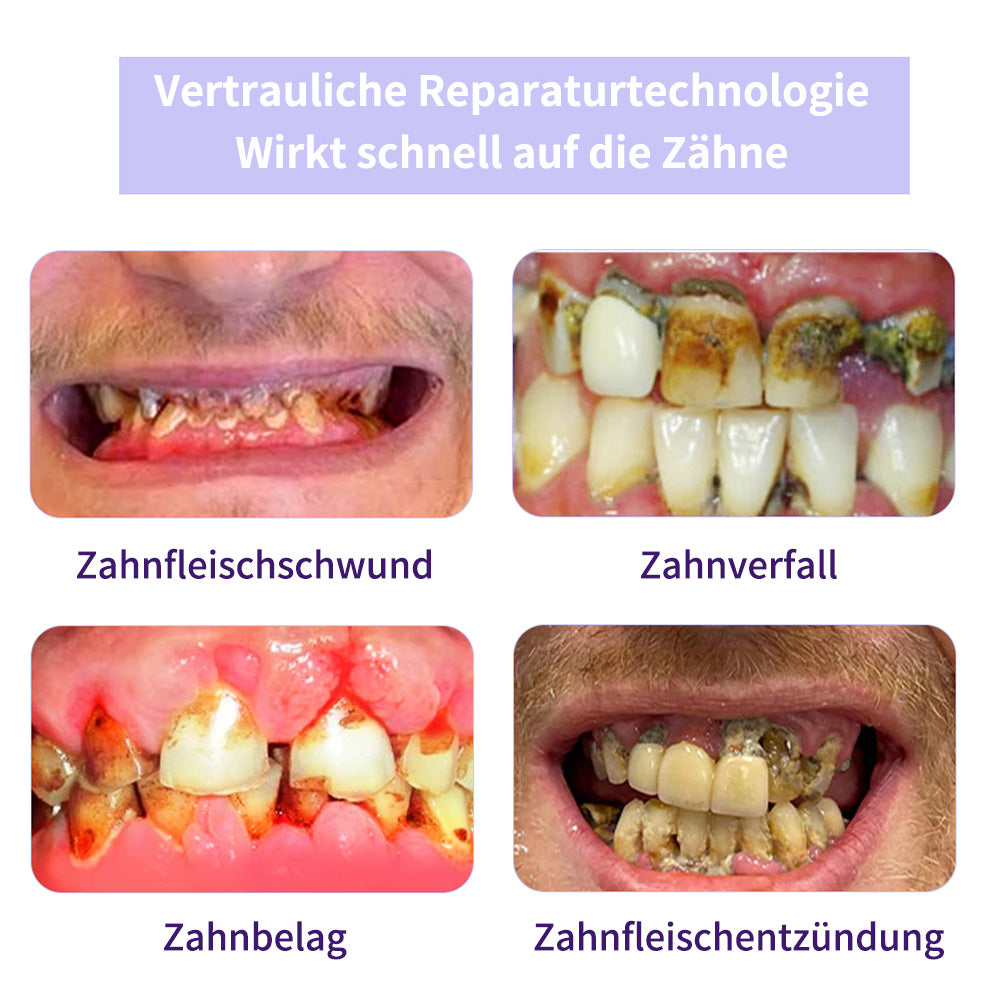 Zahnreparatur-Mineralpuder💧Cvreoz® Zusätzliche 30 % Rabatt