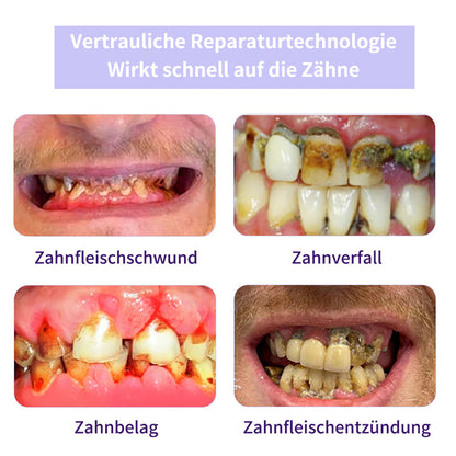 Zahnreparatur-Mineralpuder💧Cvreoz® Zusätzliche 30 % Rabatt