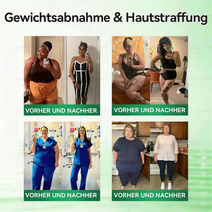 𝗢ffizieller Shop | 🛡 𝖲𝗎𝗋𝗀𝗈ᴎ𝗂𝗑® 𝗠𝗼𝗿𝗶𝗻𝗴a · 𝗕erberin ＆ NAD＋10-IN-1 𝗙ortschrittliches 𝗡ano-Mikronadel-𝑷𝒇𝒍𝒂𝒔𝒕𝒆𝒓 (1x täglich, sichtbare Veränderungen in 7 Tagen) ✨ Für Adipositas, Herz-Kreislauf-Gesundheit, Diabetes, Schlafapnoe, Gelenkprobleme u.v.m🏆